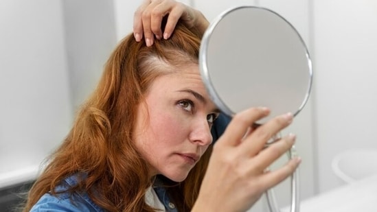 Can’t stop pulling your hair? It could be sign of this mental health disorder