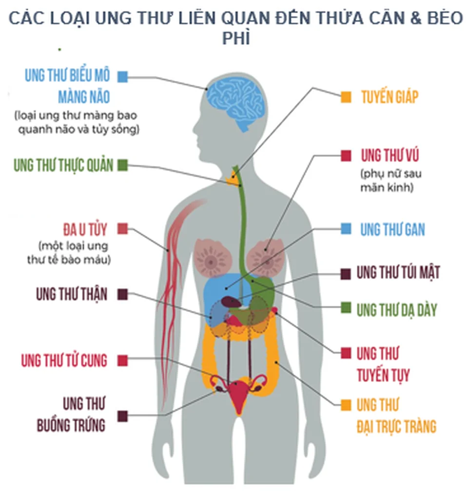 Đại dịch béo phì đang bùng phát trên toàn cầu - 5