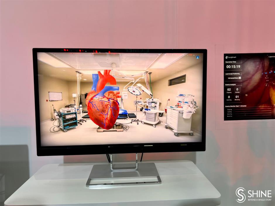 AI gadgets shine at medical tech show in Shanghai