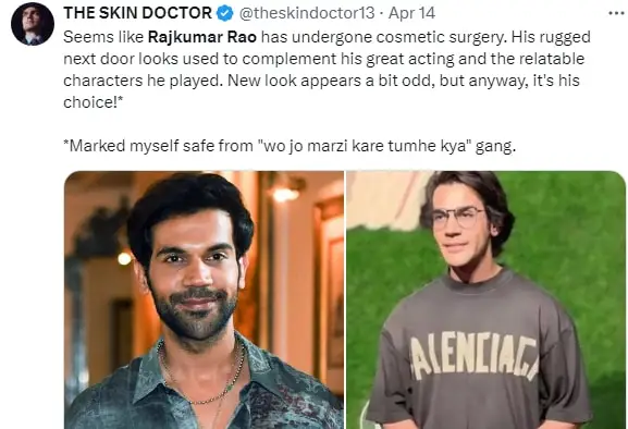 Rajkummar Rao Cosmetic Surgery