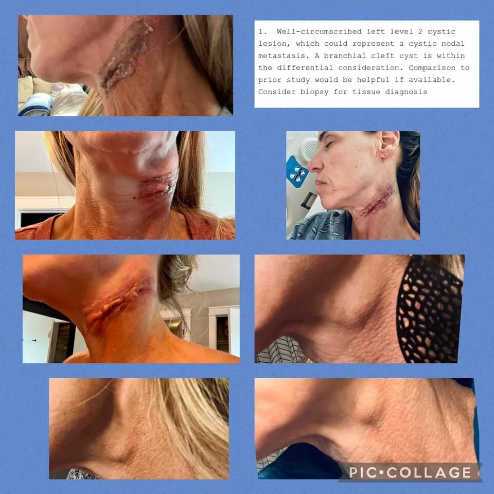 Laura French Neck 