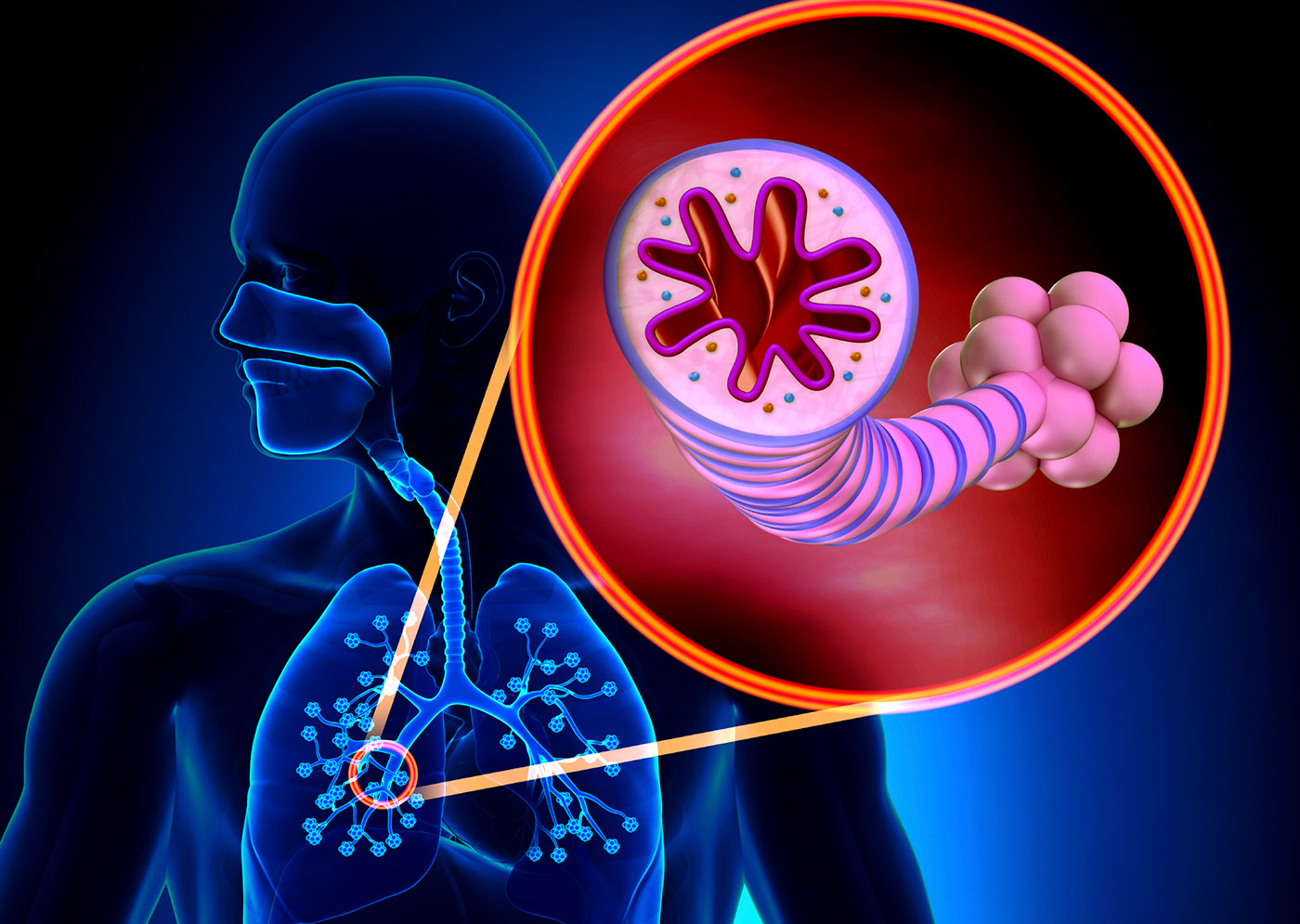 Allergic Asthma Abated Using CAR T Cell Therapy in Mice