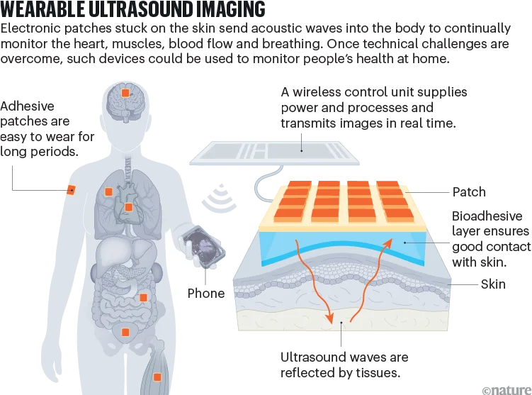 Wearable ultrasound imaging. A graphic showing how adhesive patches interact with the skin and how ultrasound scan images are recorded and transmitted.