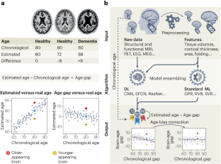 A perspective on brain-age estimation and its clinical promise