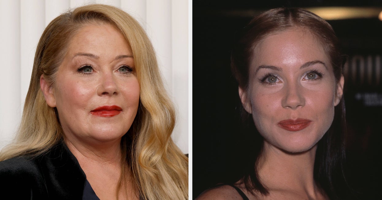 Christina Applegate Revealed The One Cosmetic Procedure She Had Done After A “Very Famous” Producer Criticized Her Appearance