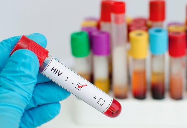 Người thứ 7 khỏi HIV: Sắp tới “chương cuối” của căn bệnh thế kỷ?