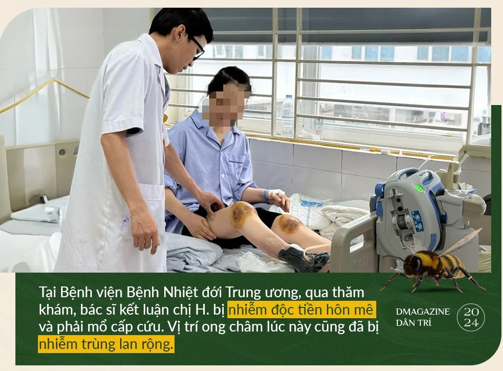 Bác sĩ giật mình vì người Việt cho ong đốt chân, đắp tỏi lên mặt chữa bệnh - 3