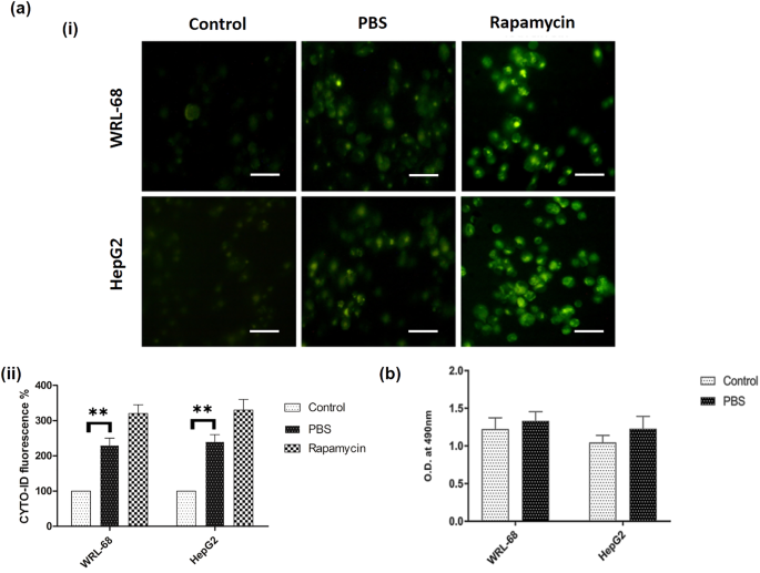 5-Fluorouracil induces apoptosis in nutritional deprived hepatocellular carcinoma through mitochondrial damage