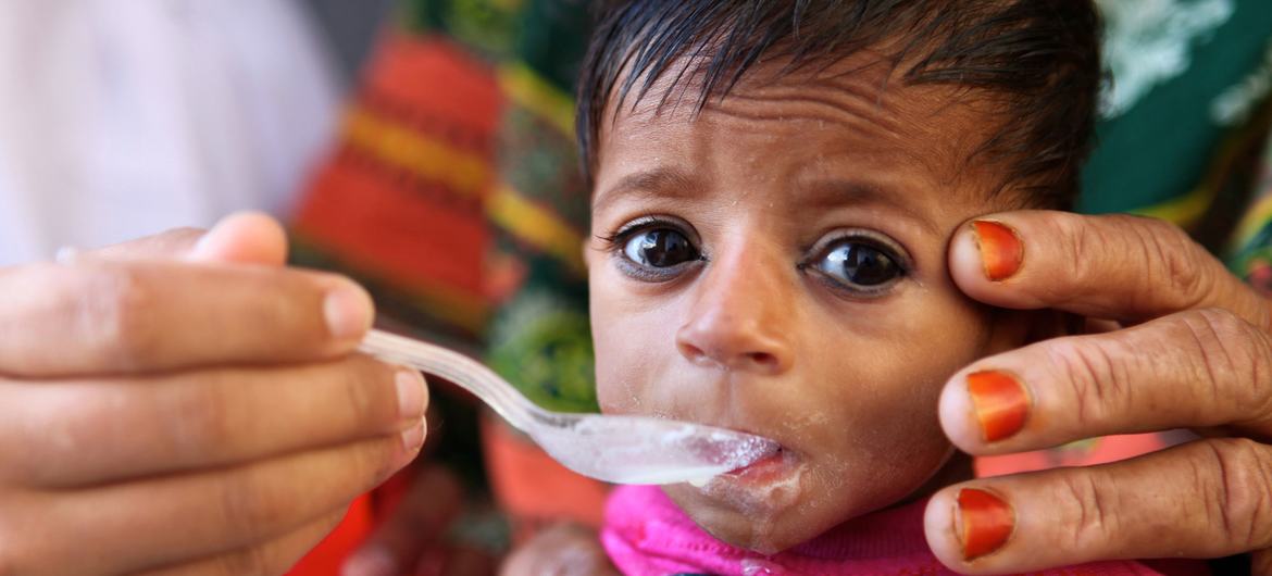 UNICEF seeks $165 million for therapeutic food to combat ‘silent killer’