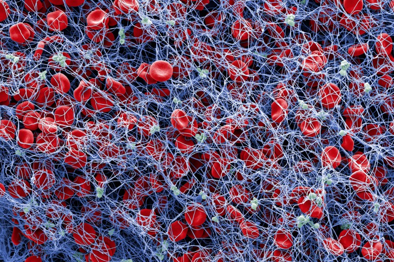 ‘Neural tourniquet’ controls bleeding with nerve stimulation