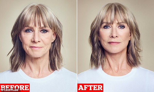 I aged overnight when I hit 60 so I took the plunge with a facelift