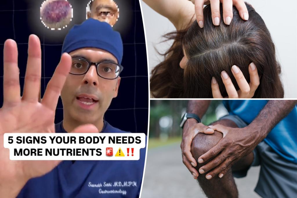 I’m a doctor — here are 5 signs your body needs more nutrients