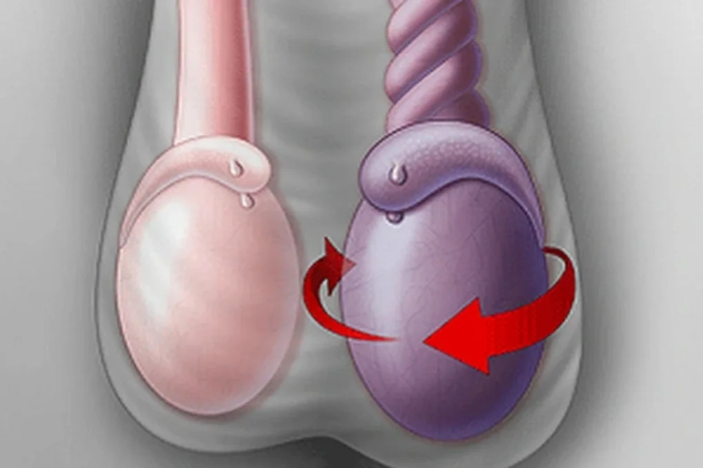 Nam sinh suýt mất tinh hoàn vì bệnh hay gặp khi trời trở lạnh - 1