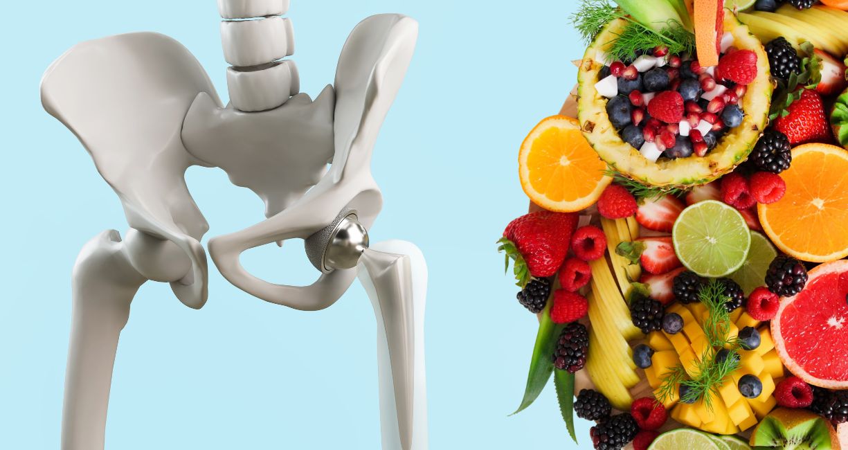 Nutrition and social support important for hip fracture recovery