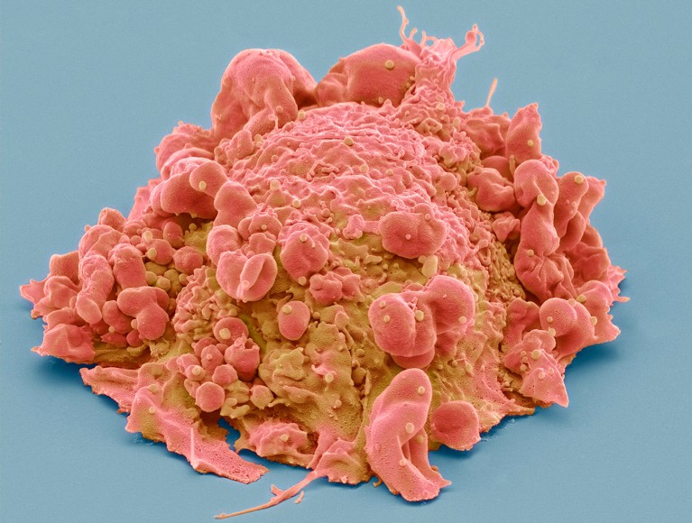 Ultra-precise 3D maps of cancer cells unlock secrets of how tumours grow