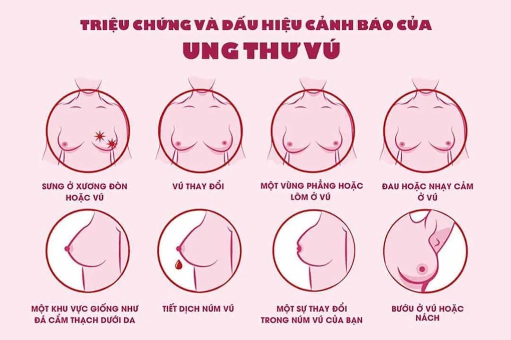 Từ tuổi 40, chị em cần làm điều này để phát hiện sớm ung thư vú - 2