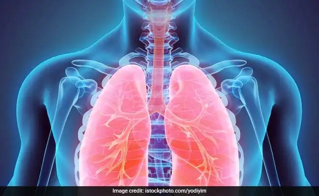 World COPD Day 2024: These Lifestyle Changes Can Improve Your Lung Health