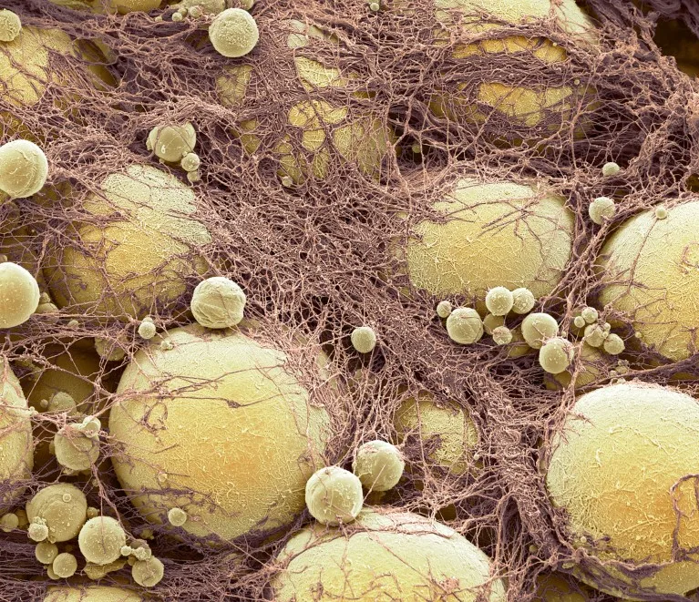 Coloured scanning electron micrograph of joined fat-storing cells shown in yellow