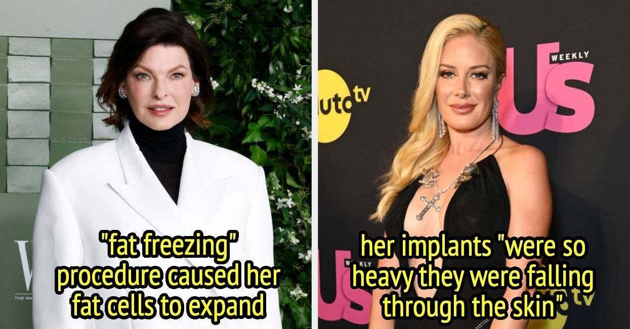 14 Celebs Who’ve Been Candid About The Negative Side Effects Of Their Cosmetic Procedures