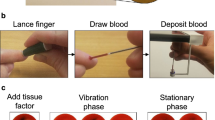 Microplastic particles in human blood and their association with coagulation markers