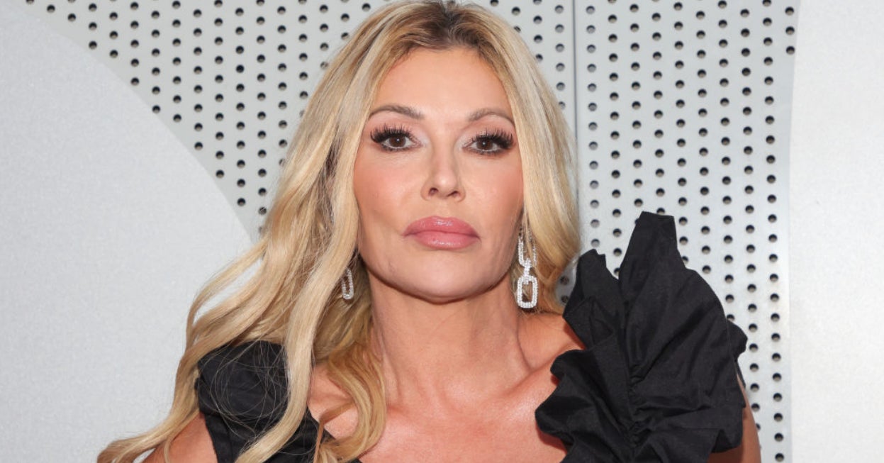 “Real Housewives” Brandi Glanville Shared A Photo Revealing She Has A Potential “Face Parasite”