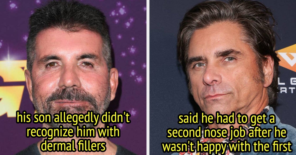 7 Famous Men Who Regretted Cosmetic Surgery