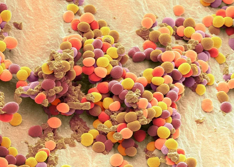 A coloured scanning electron micrograph of Staphylococcus bacteria.