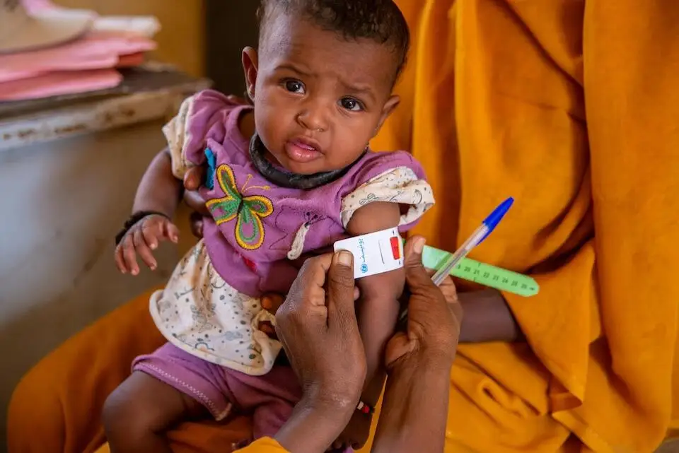 On Dec. 2, 2024, Jamila brings her daughter Amna to a UNICEF-supported health facility for treatment in Aroma locality, Kassala state, Sudan.