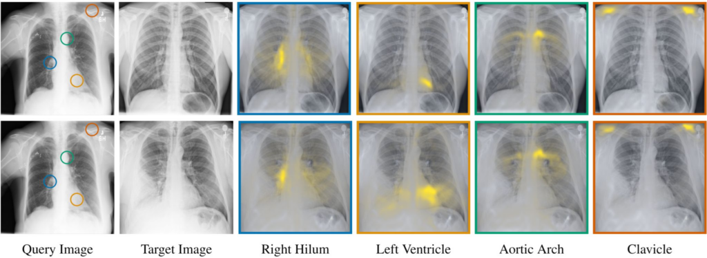 2 AI breakthroughs unlock new potential for health and science