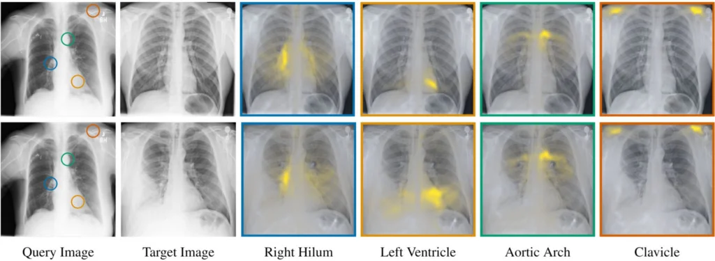 x-rays