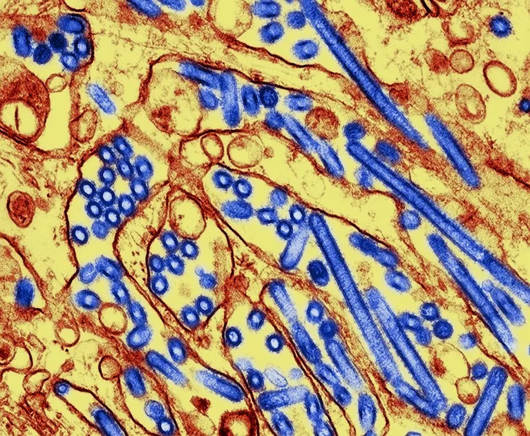 Coloured transmission electron micrograph (TEM) of influenza A virus particles of avian flu strain H5N1.