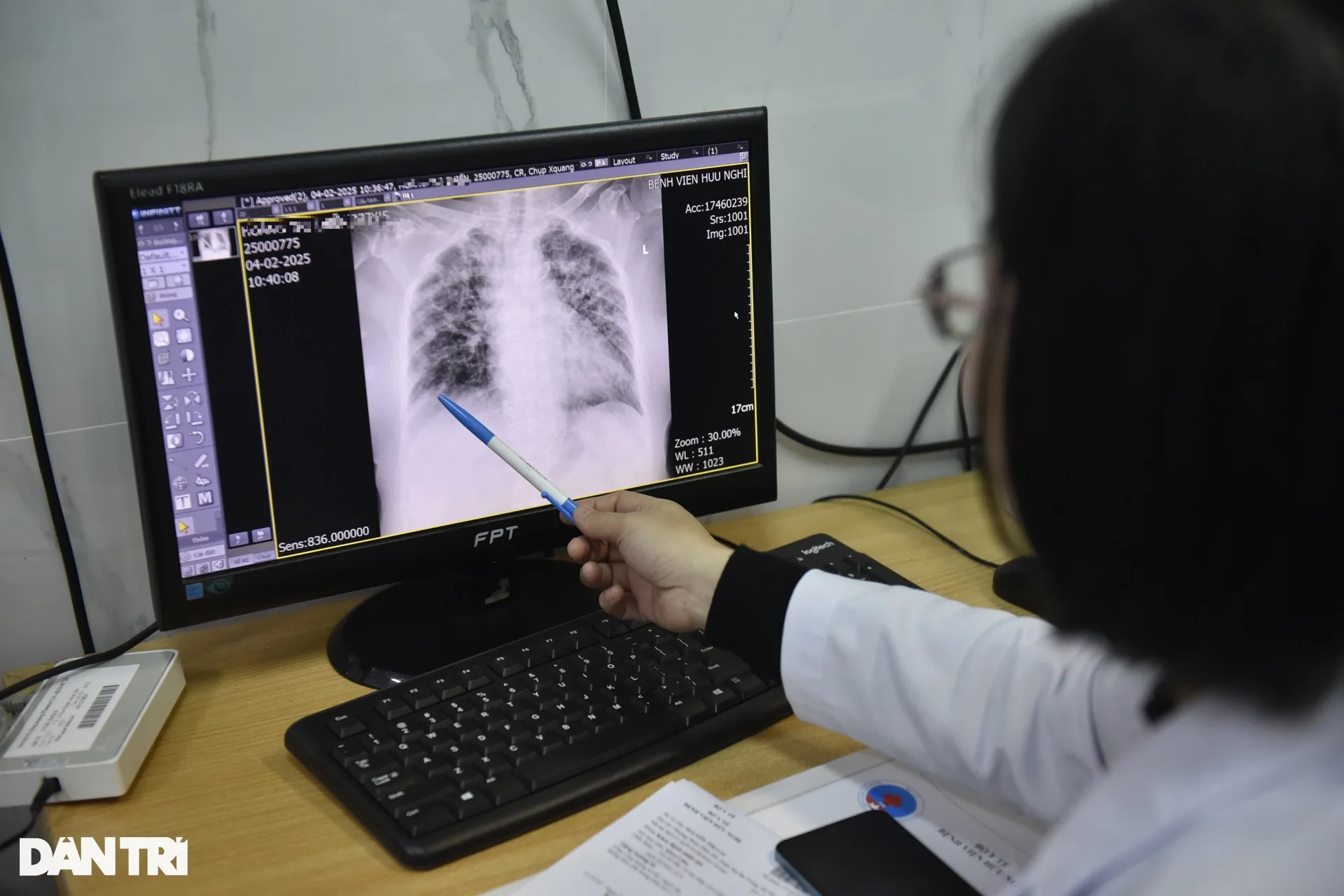 Bệnh nhân phổi trắng, mất Tết vì cúm A - 2 Bệnh nhân phổi trắng, mất Tết vì cúm A - 2