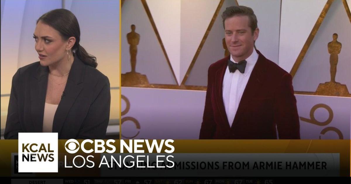 Armie Hammer’s stunning admission and other entertainment news