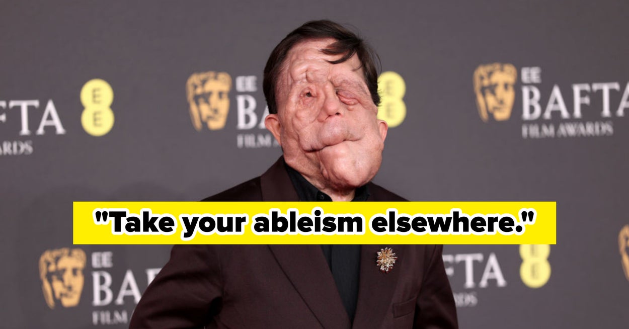 Adam Pearson Has Been The Target Of Disgusting Online Comments, And I Hate How Cruel People Can Be