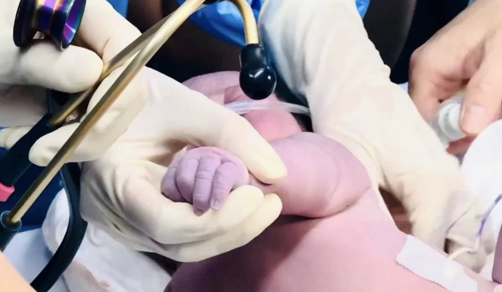 Ekip 16 người căng não cứu núm ruột cho vợ chồng bác sĩ đã 2 lần mất con - 4 Ekip 16 người căng não cứu núm ruột cho vợ chồng bác sĩ đã 2 lần mất con - 4