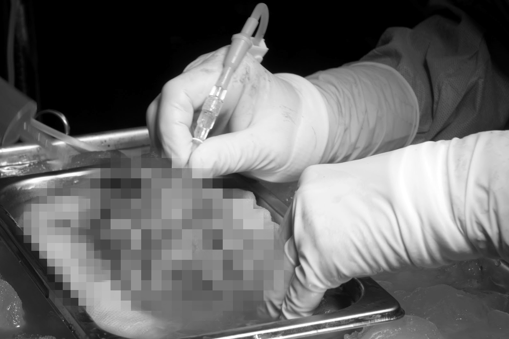 Mất con vì căn bệnh quái ác, cô gái hồi sinh cuộc đời nhờ được bố hiến thận