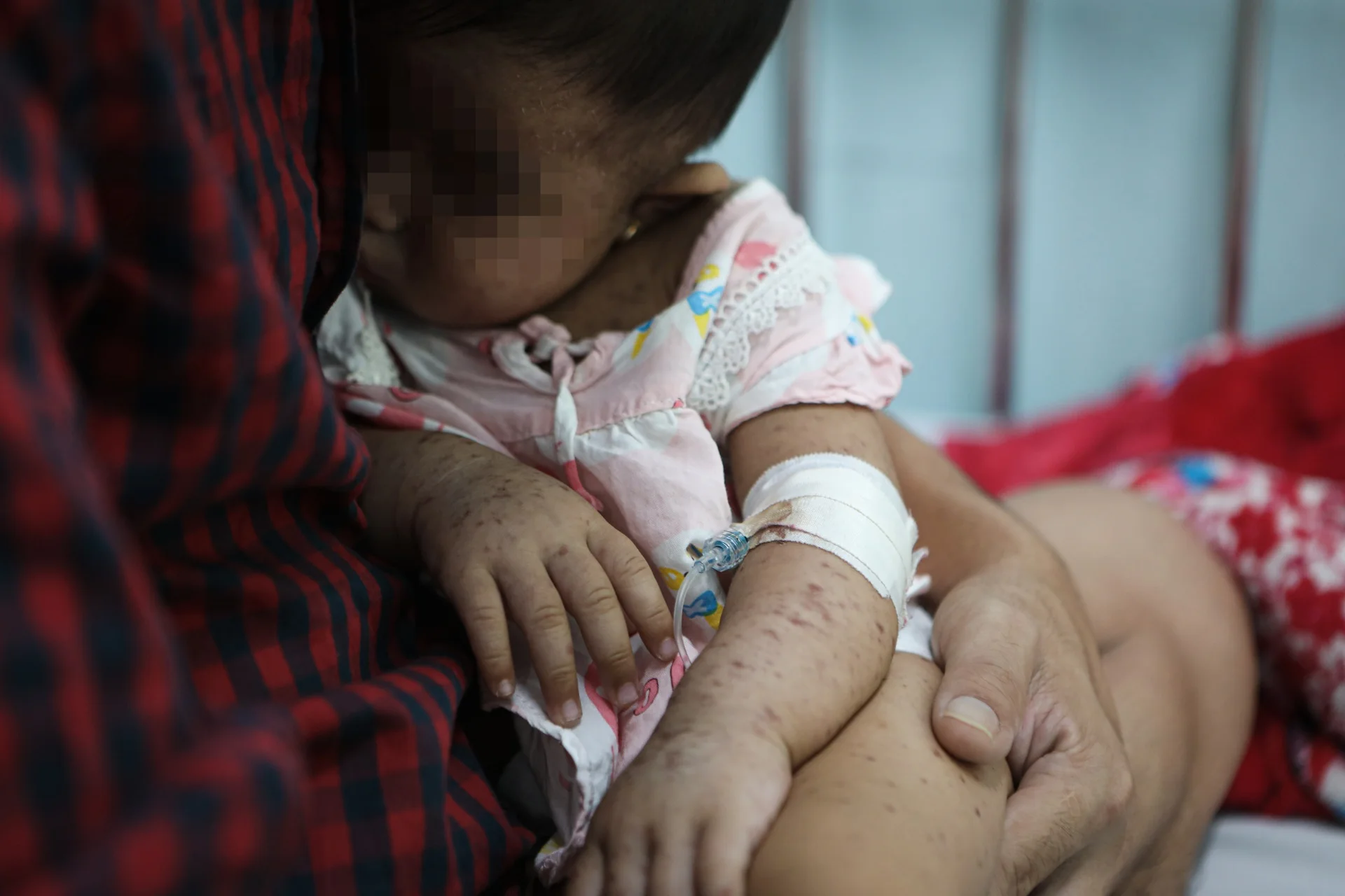 Những em bé đeo ống thở, mệt nhoài trong viện vì không tiêm vaccine sởi - 13 Những em bé đeo ống thở, mệt nhoài trong viện vì không tiêm vaccine sởi - 13
