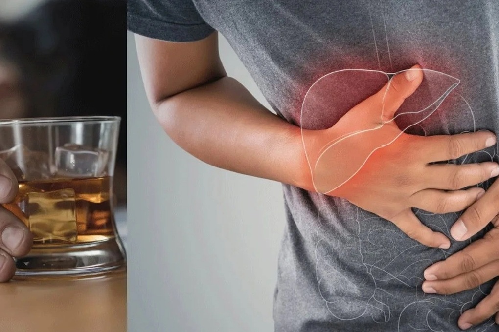 6 “sát thủ” âm thầm tàn phá gan, bạn có đang mắc phải?