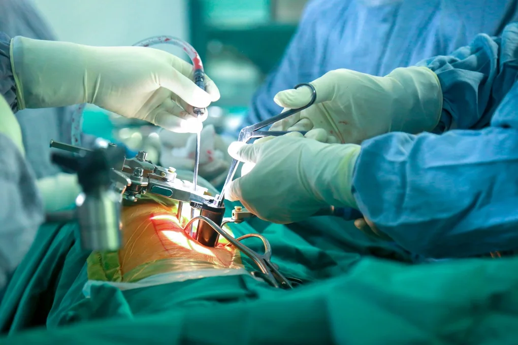 Phẫu thuật cột sống không còn lo đụng chạm dây thần kinh - 2 Phẫu thuật cột sống không còn lo đụng chạm dây thần kinh - 2