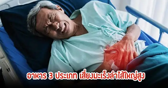 เตือน! อาหาร 3 ประเภท เสี่ยงมะเร็งลำไสสูง พบคนไทยหลายคนชอบมาก