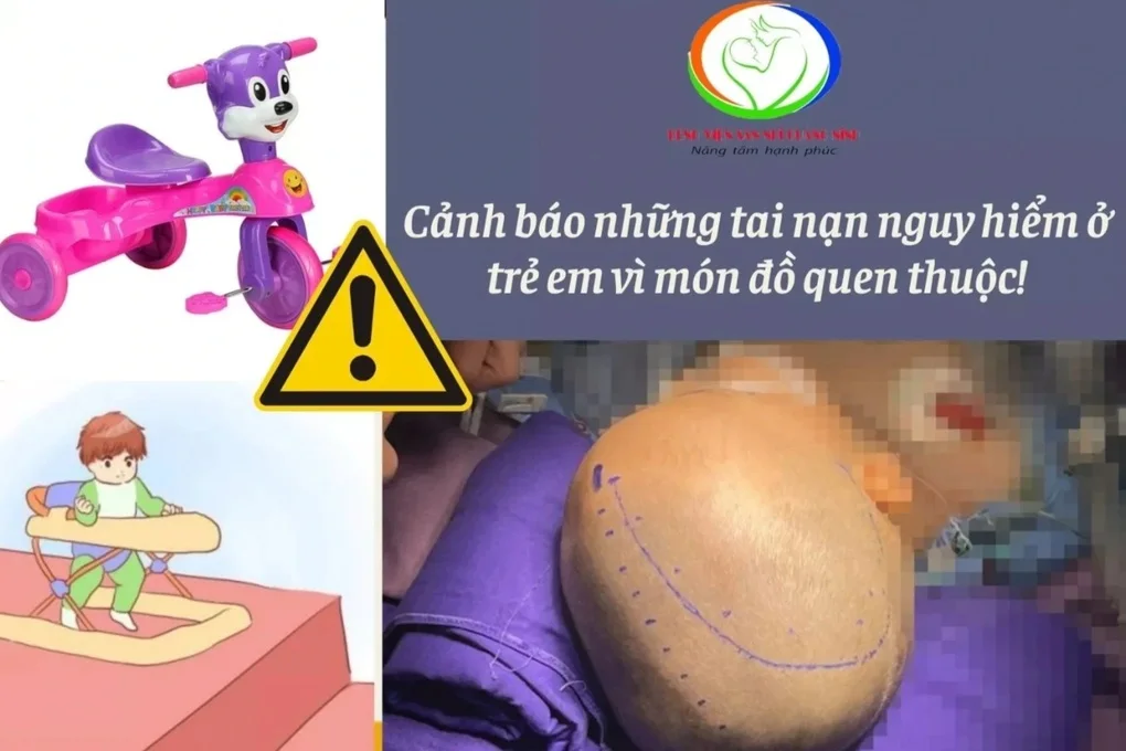 Ngã xe 3 bánh, bé 15 tháng tuổi tụ máu não - 1
