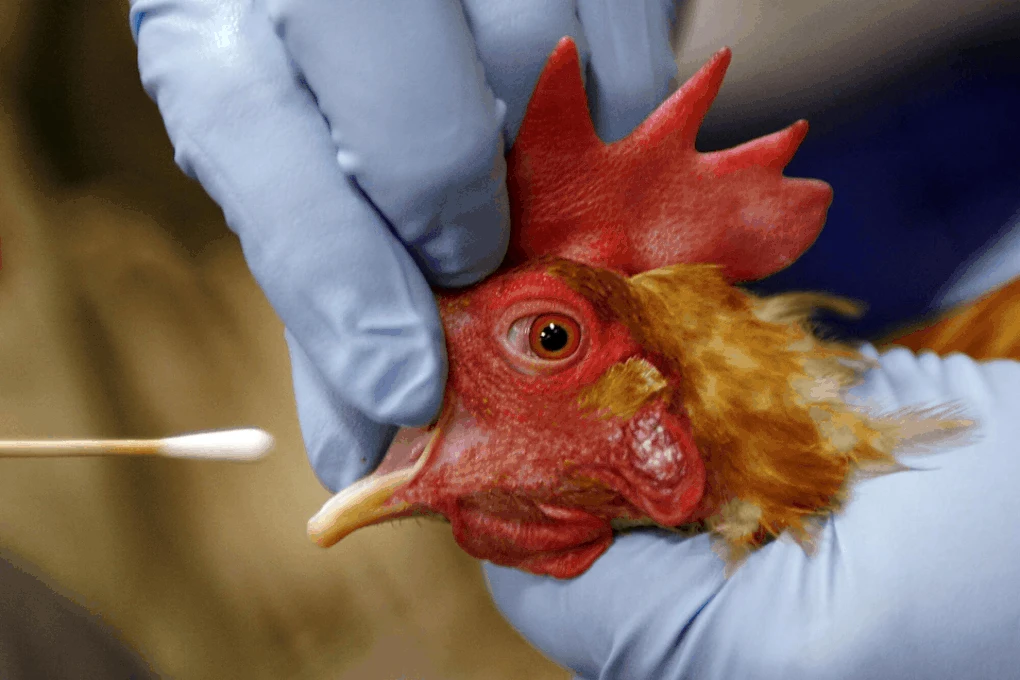 TPHCM phát hiện trường hợp viêm não hiếm gặp do virus cúm gia cầm H5N1 - 1