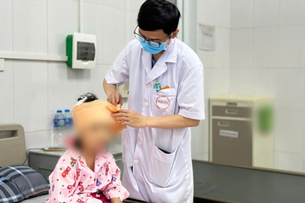 Hà Nội: Bé gái 5 tuổi bị chó nhà cắn liên tiếp vào đầu – mặt