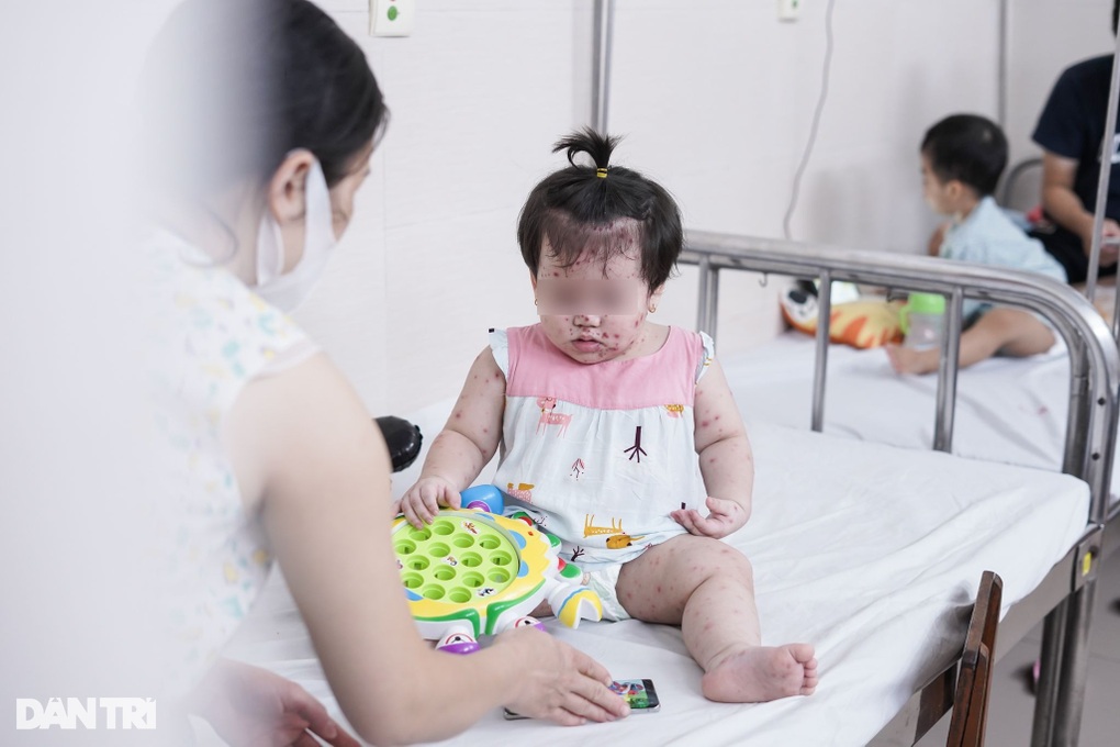 Hà Nội: Một dịch bệnh vượt sởi về ca bệnh trong tuần, gặp nhiều ở trẻ em