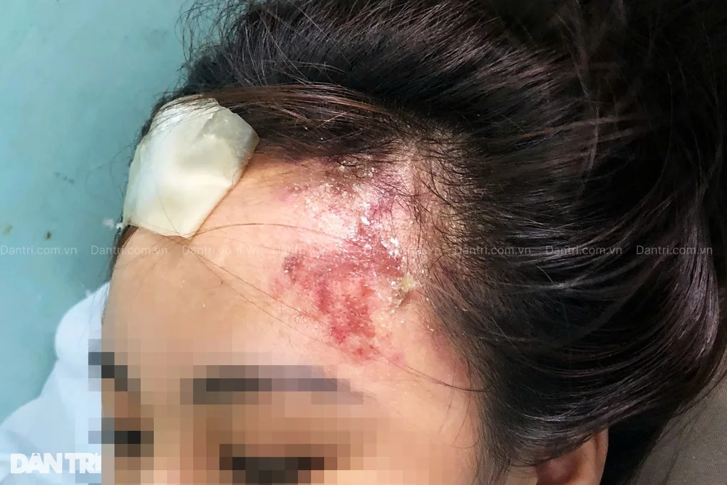 TPHCM: Cấp cứu 6 phụ nữ bị tai biến nặng nề vì tiêm filler - 3 TPHCM: Cấp cứu 6 phụ nữ bị tai biến nặng nề vì tiêm filler - 3