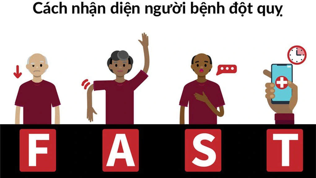 Cách nhận diện nhanh dấu hiệu người bị đột quỵ trong cộng đồng