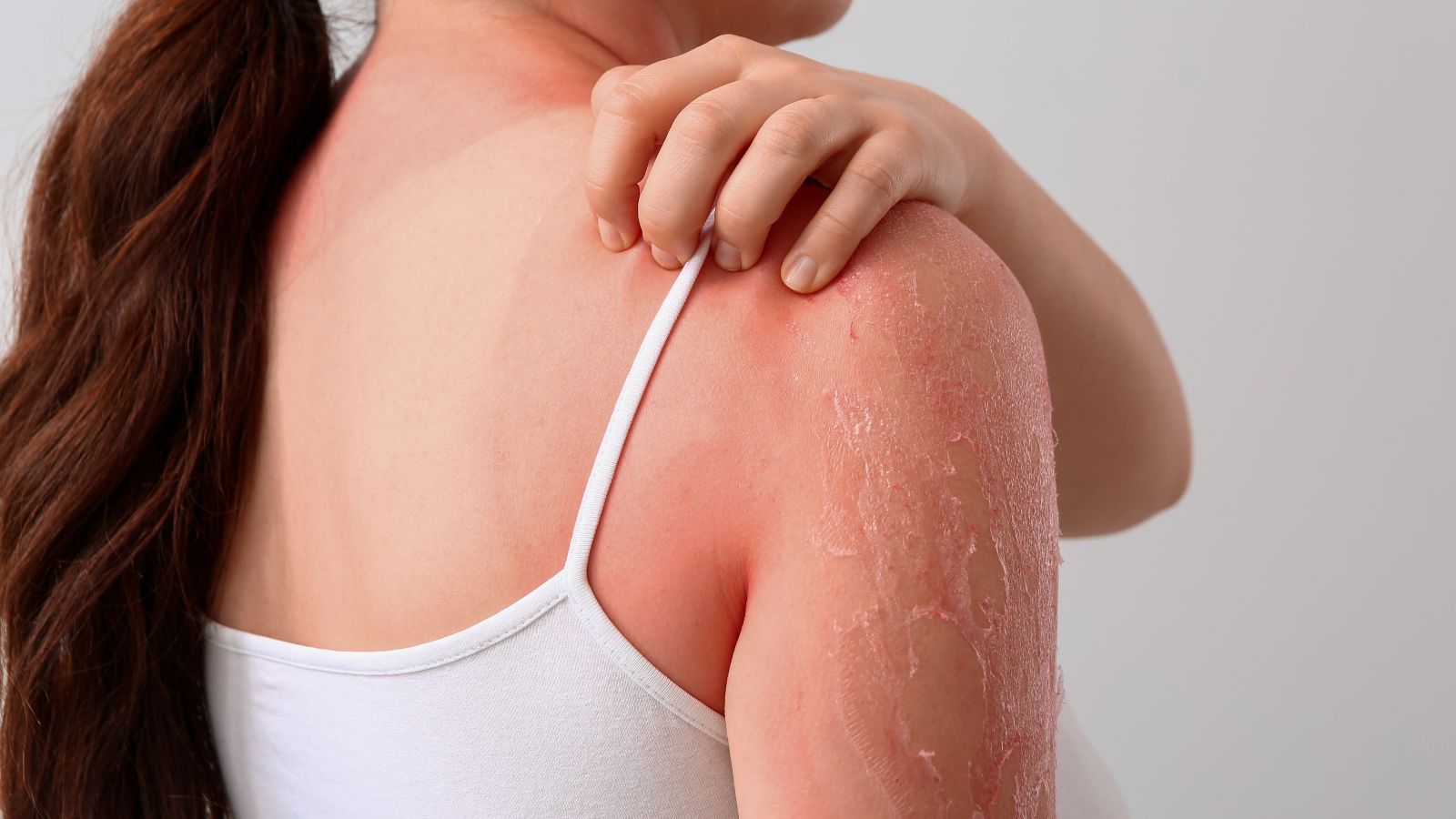 World Lupus Day 2025: 10 foods to include in a lupus diet if you have this autoimmune disease