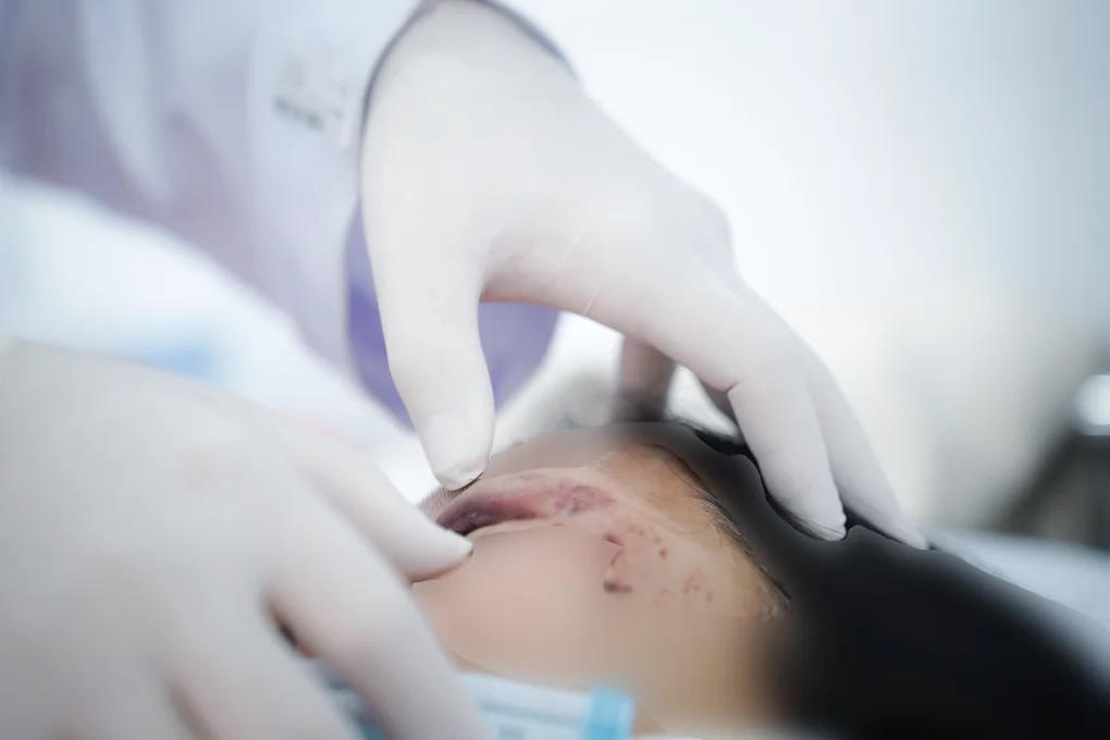 Ô tô chở đoàn hành hương 24 người tông vào xe tải, nhiều nạn nhân cấp cứu - 3 Ô tô chở đoàn hành hương 24 người tông vào xe tải, nhiều nạn nhân cấp cứu - 3