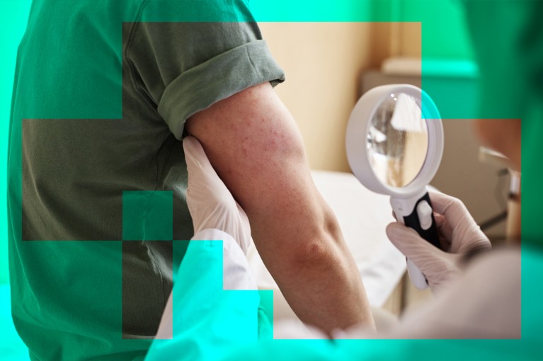 Google AI better than human doctors at diagnosing rashes from pictures