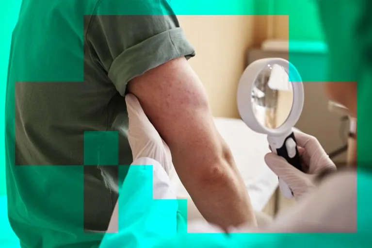 A doctor looking at a rash on a person's arm with a magnifying glass, with a green frame of square pixels